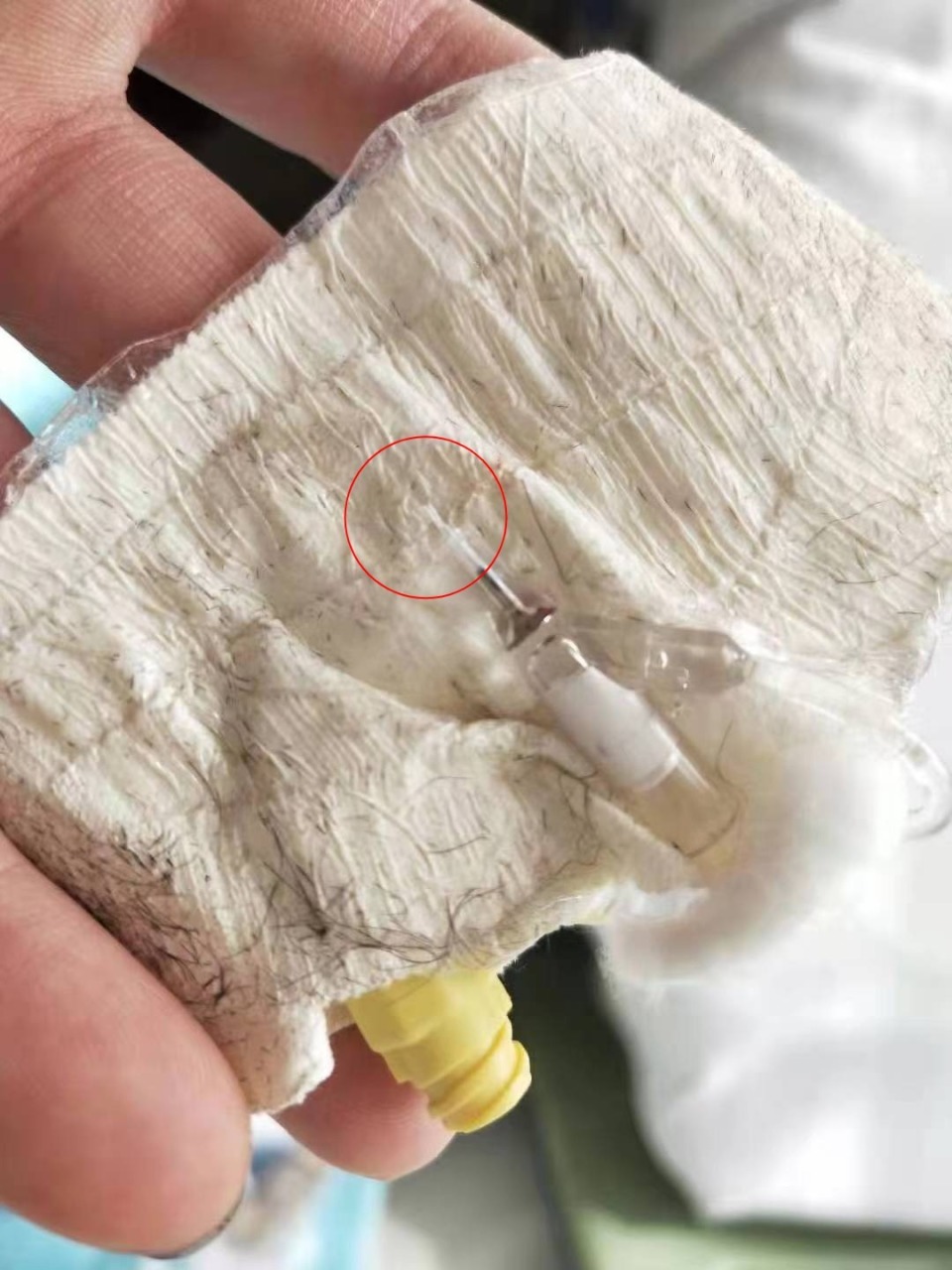 血管的挑战，抽血过程中的艰难寻找