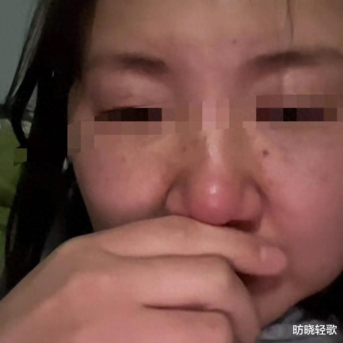 女子因拔错牙坠亡事件引发社会关注，涉事医生被停诊
