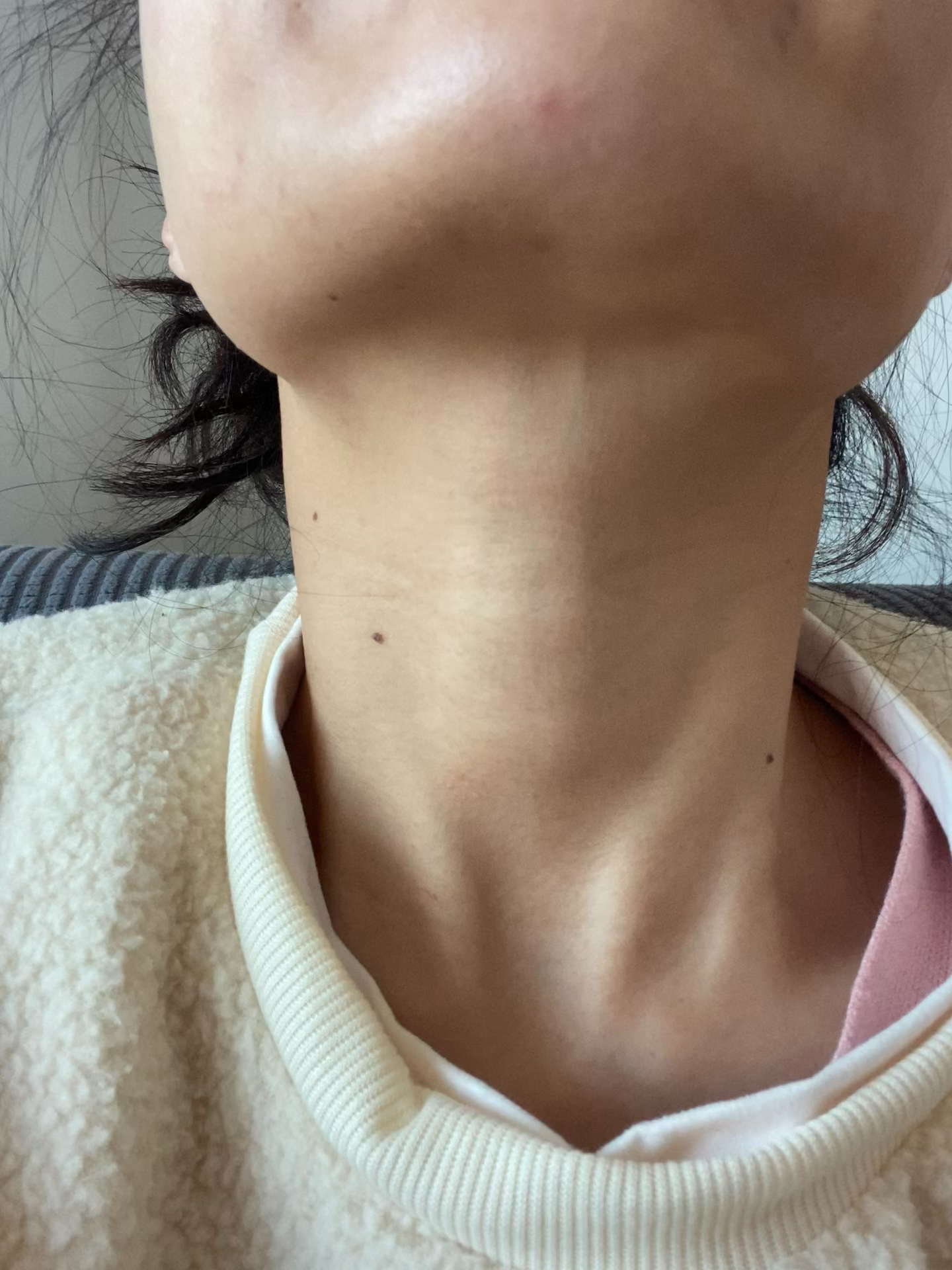 甲亢女孩能否找到好男朋友？