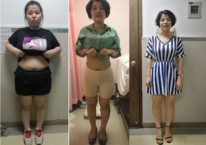 从326斤减到170斤，我的减肥历程与心得分享