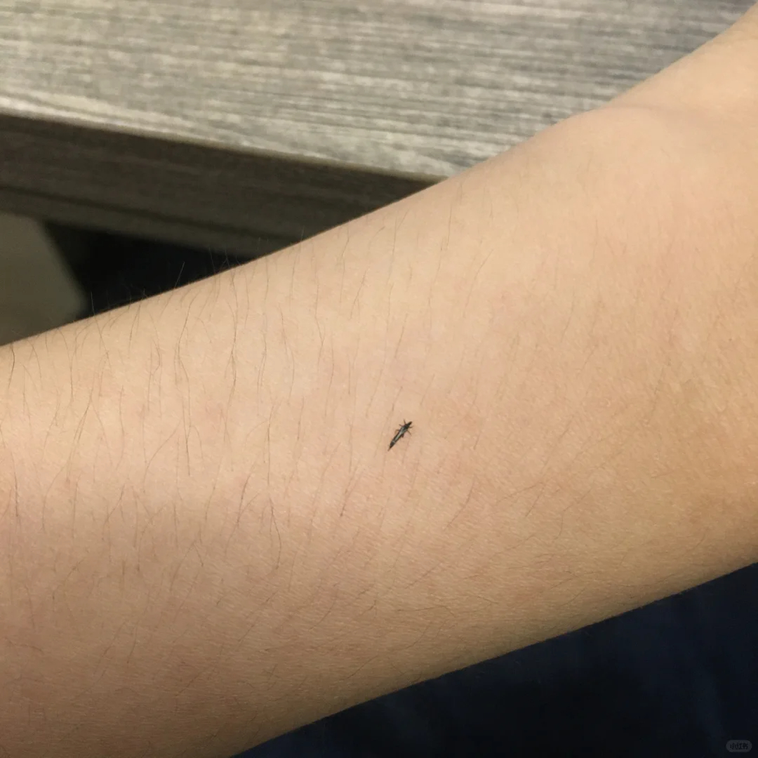 景区虫子往脖子里钻，一种独特的旅游体验？