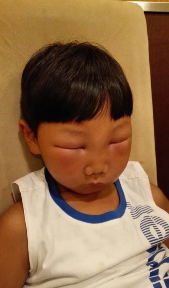 被蜜蜂蜇的小孩，一次意外的成长经历