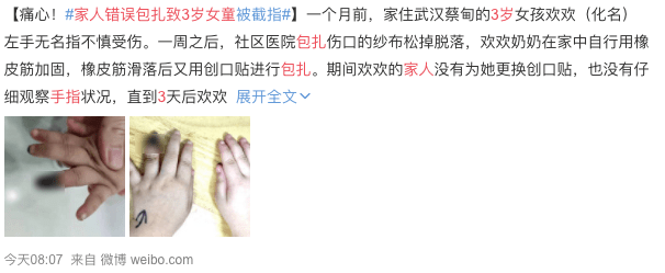 多位捏捏玩家遭遇喉咙痛与烂手指，游戏健康隐患引关注